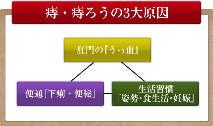 痔・痔ろうの3大原因
